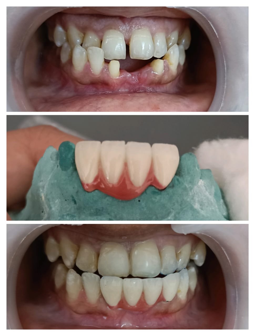 After Treatment